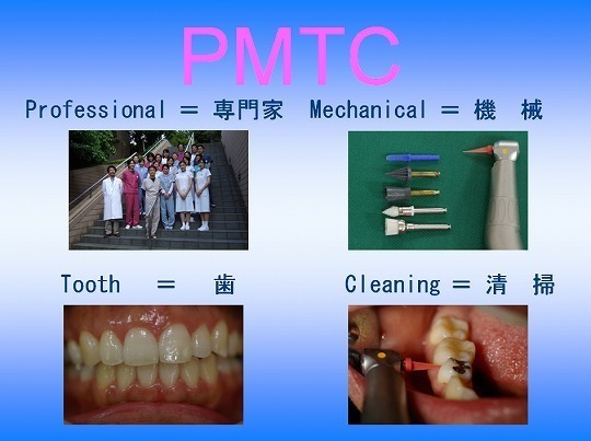 健康歯考講座：PMTCで得られる効果 〜PMTCって、いったい何？〜